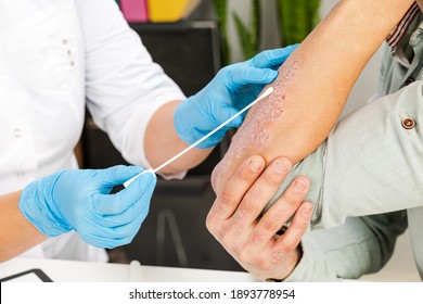 A Dermatologist Takes A Skin Analysis Of A Sick Patient. Examination And Diagnosis Of Skin Diseases-allergies, Psoriasis, Eczema, Dermatitis