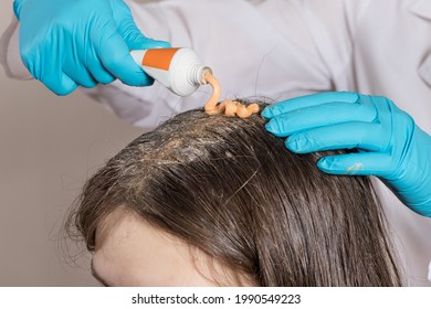 A dermatologist or trichologist applies a dandruff or lice weed to the patient's hair. Treating psoriasis, hair loss, dermatitis or head lice.