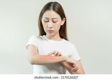 Dermatology Asian Young Woman Girl Allergy Stock Photo 2170126207