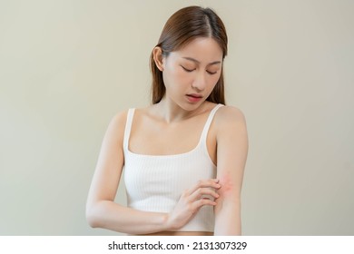 Dermatology, asian young woman looking on her arm allergy, allergic reaction from atopic, insect bites, hand in scratching itchy, itch red spot or rash of skin. Beauty problem by medical treatment.