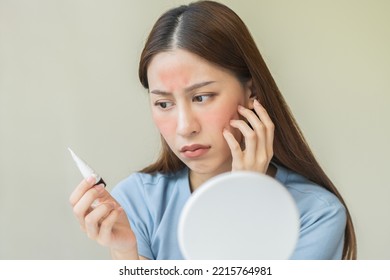 Dermatology, Asian Young Woman Looking At Mirror, Holding Cream Tube In Hand, Expression Worry And Itch, Itchy Allergy Or Allergic Sensitive Reaction, Red Or Rash On Face. Beauty Care Of Skin Problem