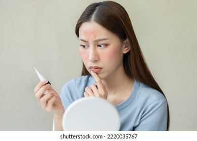 Dermatology, Asian Young Woman Looking At Mirror, Holding Cream Tube In Hand, Expression Worry And Itch, Itchy Allergy Or Allergic Sensitive Reaction, Red Or Rash On Face. Beauty Care Of Skin Problem