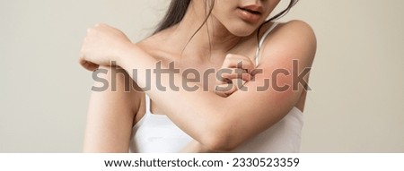 Dermatology, asian young woman reaction from atopic, insect bites on her arm, hand in scratching itchy red spot or rash of skin. Healthcare, treatment of beauty.