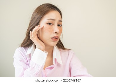 Dermatology, expression face worry, stressed asian young woman hand touching facial at dark spot of melasma, freckles from pigment melanin, allergy sun. Beauty care, skin problem treatment, skincare. - Shutterstock ID 2206749167