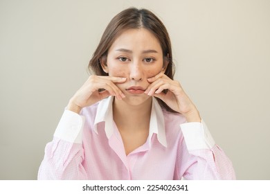 Dermatology, expression face worry, stressed asian young woman hand touching facial at dark spot of melasma, freckles from pigment melanin, allergy sun. Beauty care, skin problem treatment, skincare. - Shutterstock ID 2254026341