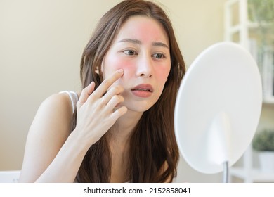 Dermatology, Puberty Asian Young Woman, Girl Looking Into Mirror, Allergy Presenting An Allergic Reaction From Cosmetic, Red Spot Or  Rash On Face. Beauty Care From Skin Problem By Medical Treatment.