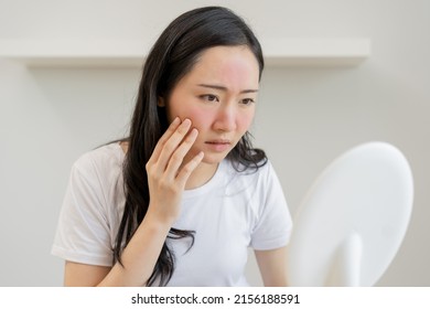 Dermatology, Puberty Asian Young Woman, Girl Looking Into Mirror, Allergy Presenting An Allergic Reaction From Cosmetic, Red Spot Or  Rash On Face. Beauty Care From Skin Problem By Medical Treatment.