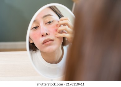 Dermatology, puberty asian young woman, girl looking into mirror, allergy presenting an allergic reaction from cosmetic, red spot or  rash on face. Beauty care from skin problem by medical treatment. - Shutterstock ID 2178110411