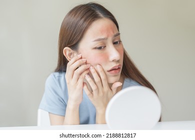 Dermatology, Scratch Asian Young Woman Looking At Mirror, Expression Worry And Itch, Itchy Allergy Or Allergic Sensitive Reaction, Red Spot Or Rash On Her Face. Beauty Care From Skin Problem Treatment