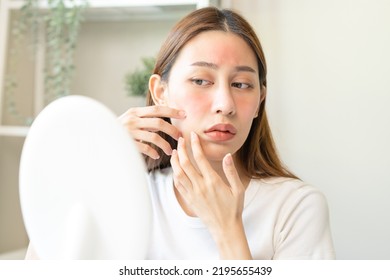 Dermatology, Scratch Asian Young Woman Looking At Mirror, Expression Worry And Itch, Itchy Allergy Or Allergic Sensitive Reaction, Red Spot Or Rash On Her Face. Beauty Care From Skin Problem Treatment