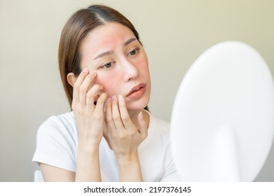 Dermatology, Scratch Asian Young Woman Looking At Mirror, Expression Worry And Itch, Itchy Allergy Or Allergic Sensitive Reaction, Red Spot Or Rash On Her Face. Beauty Care From Skin Problem Treatment