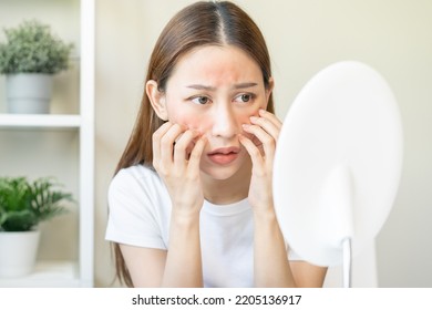 Dermatology, Scratch Asian Young Woman Looking At Mirror, Expression Worry And Itch, Itchy Allergy Or Allergic Sensitive Reaction, Red Spot Or Rash On Her Face. Beauty Care From Skin Problem Treatment