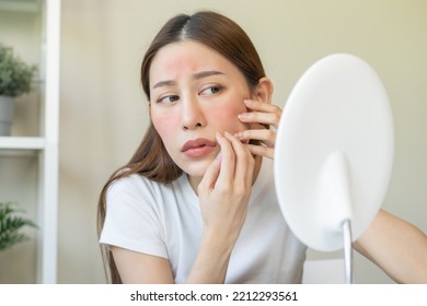 Dermatology, Scratch Asian Young Woman Looking At Mirror, Expression Worry And Itch, Itchy Allergy Or Allergic Sensitive Reaction, Red Spot Or Rash On Her Face. Beauty Care From Skin Problem Treatment