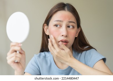 Dermatology, Scratch Asian Young Woman Looking At Mirror, Expression Worry And Itch, Itchy Allergy Or Allergic Sensitive Reaction, Red Spot Or Rash On Her Face. Beauty Care From Skin Problem Treatment