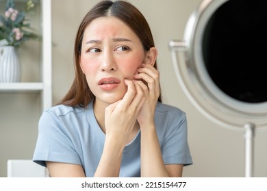 Dermatology, Scratch Asian Young Woman Looking At Mirror, Expression Worry And Itch, Itchy Allergy Or Allergic Sensitive Reaction, Red Spot Or Rash On Her Face. Beauty Care From Skin Problem Treatment