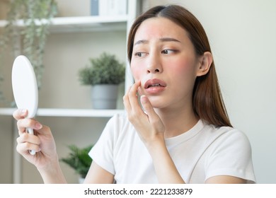 Dermatology, Scratch Asian Young Woman Looking At Mirror, Expression Worry And Itch, Itchy Allergy Or Allergic Sensitive Reaction, Red Spot Or Rash On Her Face. Beauty Care From Skin Problem Treatment