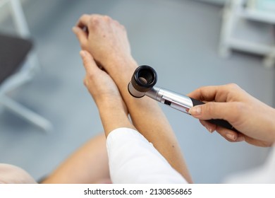 Dermatology. Skilled female dermatologist using a professional dermatoscope while doing the skin examination. Examination and diagnosis of skin diseases-allergies, psoriasis, eczema, dermatitis.