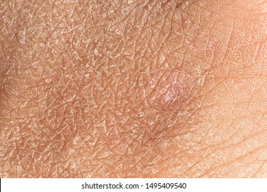 Dermatology and skincare concept with a macro view on the flaking skin of a caucasian person. Detailed view of the cracks and lines filling the frame. - Shutterstock ID 1495409540