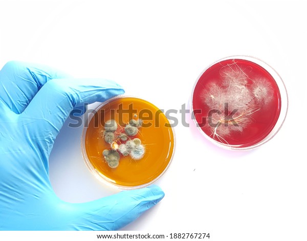 A\
dermatophyte test medium (DTM) culture in Petri dish using for\
growth media to isolate and cultivate fungal testing from clinical\
samples, investigation of ring worm (skin\
disease).