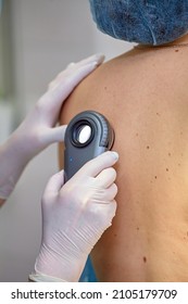 Dermatoscopy-a method of research and diagnosis of skin tumors - moles, birthmarks, nevi, warts, acne with a special optical device Dermatoscope. Prevention of melanoma, skin cancer.