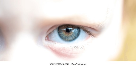 Description: Left side of Human Kid Face with one Eye and a Blue Green Brown Colored Iris. Shot in Dayllight.