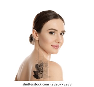 Design with photo of woman on white background during tattoo removal process