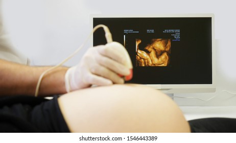 Detail of doctor hand on pregnant belly, ultrasound pictures on monitor