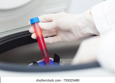 Detail Of A Doctor Using A Laboratory Centrifuge