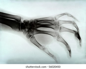 Detail Of Hand Xray Medical Image