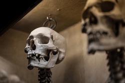 Detail Of The Head Of A Human Skeleton Hanging By The Head