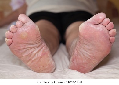 Feet old mature 