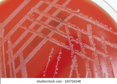 Detail of a large creamy bacterial colonies on red blood agar in a petri dish against a white background