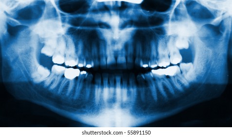 detail of panoramic facial x-ray image