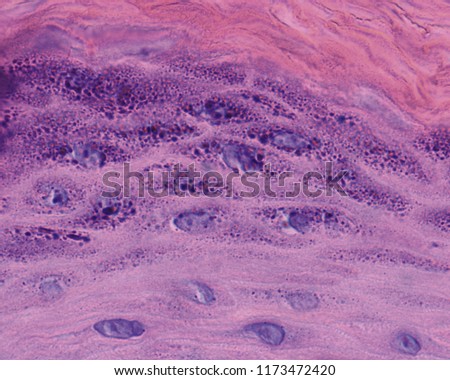Detail of the stratum granulosum of the epidermis. The keratinocytes of this layer contain numerous keratohyalin granules. Above is the stratum corneum.