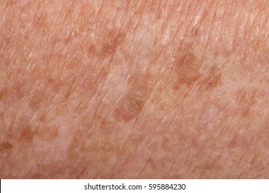 Detail Of Texture Skin, Senior Woman,arm