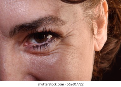 Detail of wrinkles in a woman's eyes