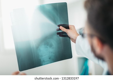 Detail of Young Radiologist on the Job looking at x-ray. Volunteer at the hospital gains practical knowledge in treating disease