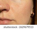 Detailed close-up of female cheek and nose showing enlarged pores, natural skin texture, and healthy glow in daylight. Great for skincare, dermatology, or beauty product visuals.