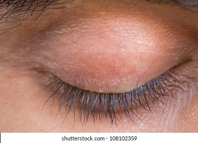 Detailed Closeup View Of Caucasian Man Closed Eyelid