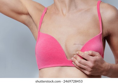 Detailed view of a female with scars from breast surgery, displaying the results while embracing her chest - Powered by Shutterstock