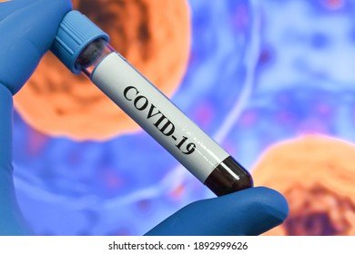 Detection of antibodies to the coronavirus. Immunoglobulin test after COVID-19. - Shutterstock ID 1892999626