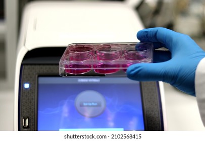 Detection Of The Novel Coronavirus SARS-CoV-2 In The Cellular And Molecular Diagnostic Laboratory