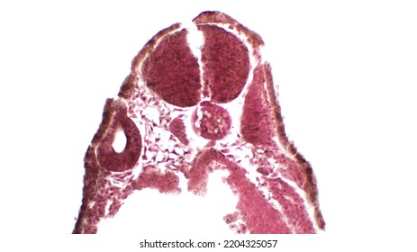 Development Of The Central Nervous System - The Stage Of The Neural Tube. Haematoxylin And Eosin Stain.