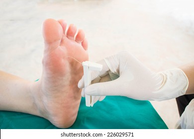 Diabatic Foot Skining Neuropathy