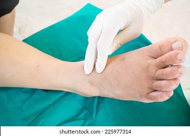 Diabetic Foot , Neuropathy