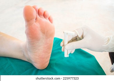 Diabetic Foot , Neuropathy