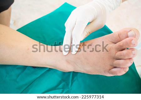diabetic foot , neuropathy