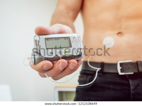 Diabetic man\
with an insulin pump connected in his abdomen and holding the\
insulin pump at his hands. Diabetes\
concept.
