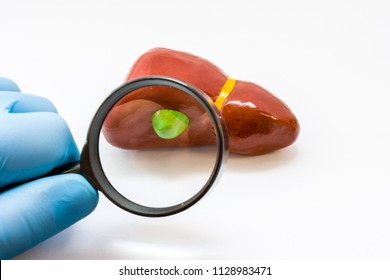 Diagnosis of gallbladder for presence of disease. Doctor hand in glove examine with magnifying glass gallbladder on  liver anatomical model on white background. Concept for surgery and gastroenterolog - Shutterstock ID 1128983471