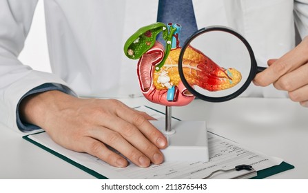 Diagnosis and treatment of pancreatic disease. Doctor consulting patient with acute pancreatitis patient pointing out pancreatic disease on anatomical model - Shutterstock ID 2118765443